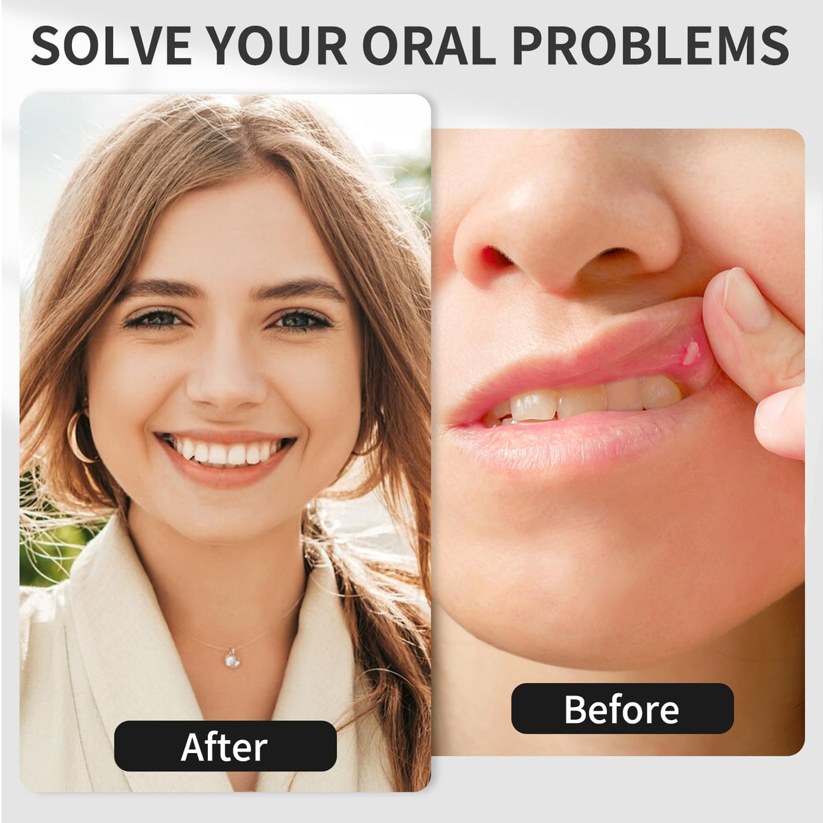 Red Light Oral Therapy Device