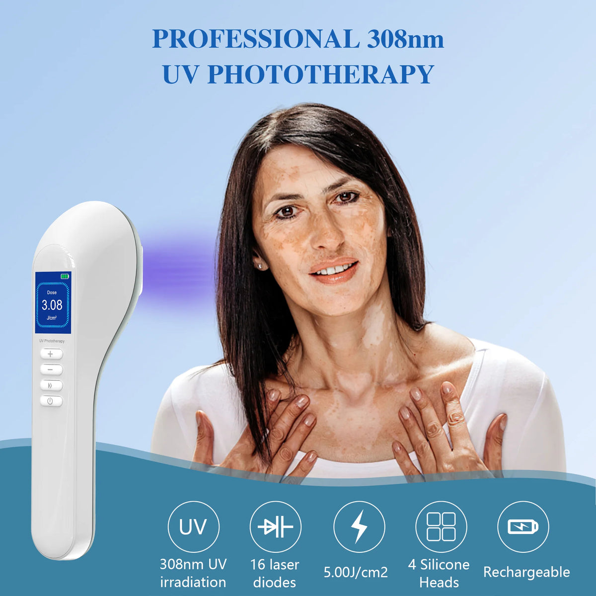 Handheld UVB Phototherapy Device for Vitiligo & Psoriasis - Portable 308nm Light Therapy Lamp by UVBtreatment